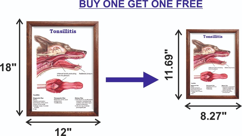 Tonsillitis Chart 12x18 inches