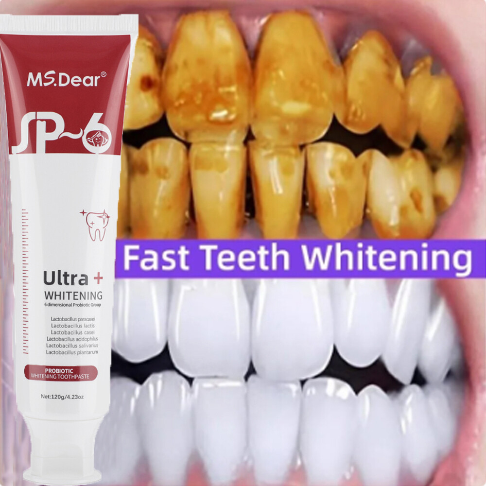 2Pack SP-6 Probiotic Toothpaste,Sp-6 Toothpaste Whitening Quick White Toothpaste
