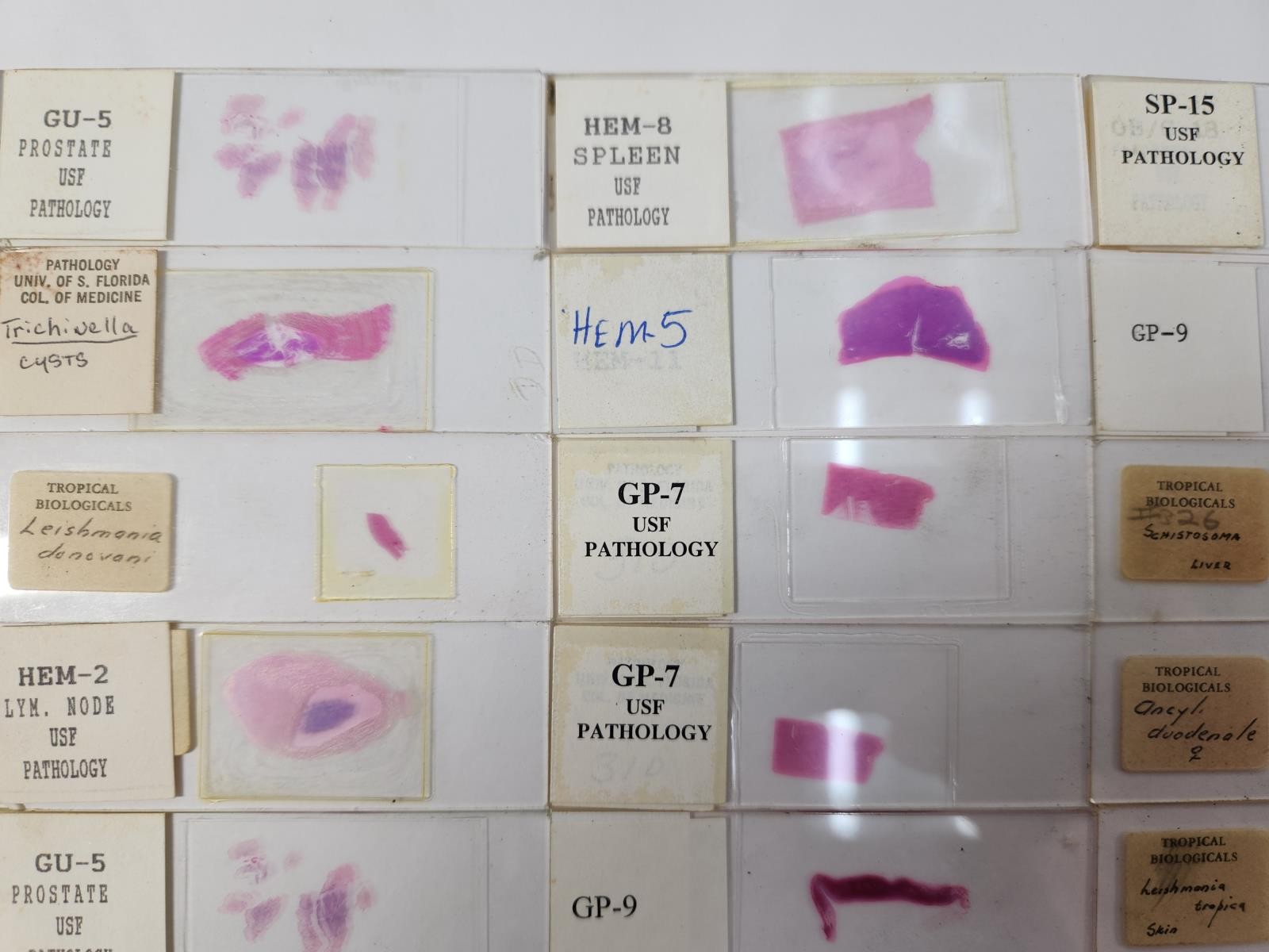 Lot Of 50 Vintage University Prepared Pathology Microscope Slides - Slides Only