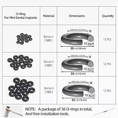 O-Ring Buna-N Tool Kit with 3 Convenient Sizes for Mini Dental Implants