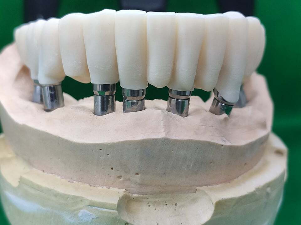 DLP SLA LCD 3d printer temporary teeth resin ..