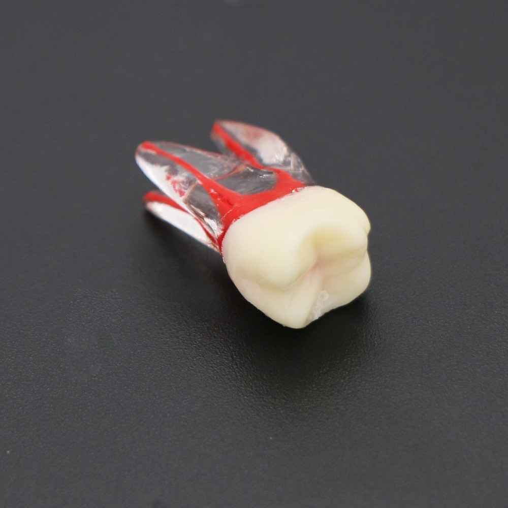 Dental Teeth Root Canal RCT Block Pulp Cavity Practice Model for Endo File Study