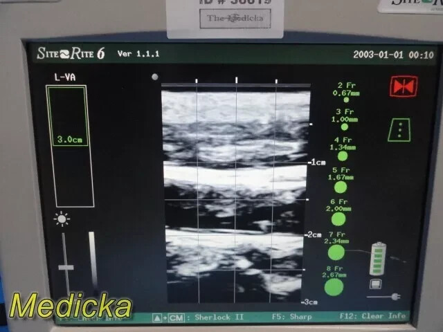 Chison Tech L-VA Linear Array Probe – Vascular Imaging for SR-6 (Tested) ~ 36100