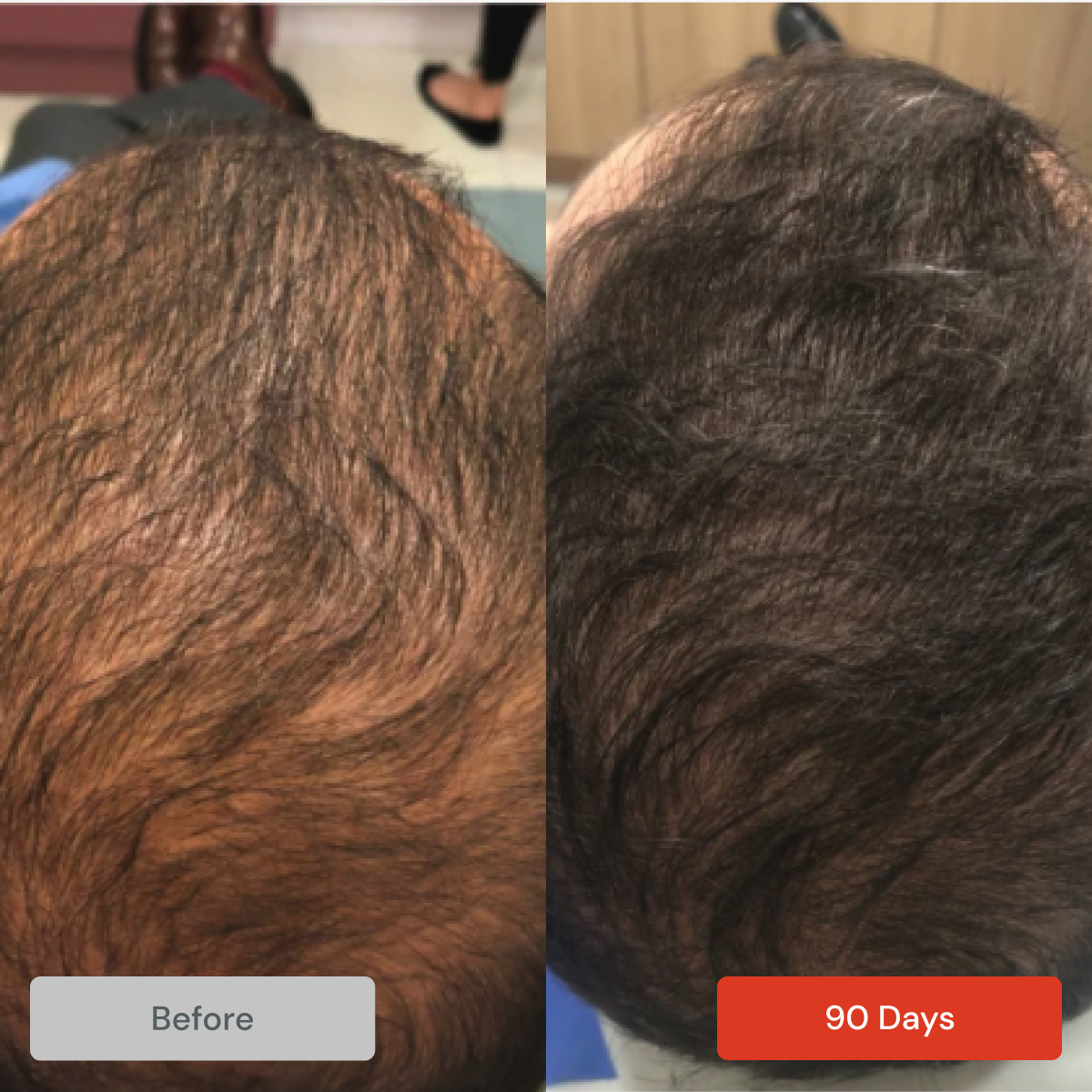 Spectral DNC-N® Redensifying w/ Nanoxidil by DS Laboratories