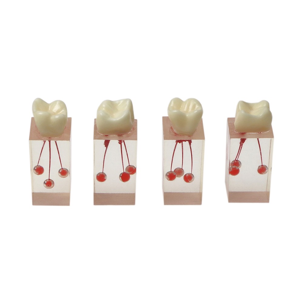 10Pcs Dental Endo Root Canals Teeth Model Practice Block RCT Pulp Cavity Study