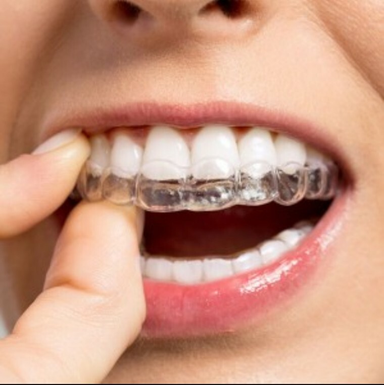 SAVE!*2* Quality Clear Dental Teeth Retainers* *No Hidden Fees!!* Upper & Lower