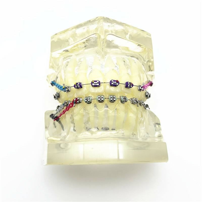 Dental Model Orthodontic Teeth Model With Brackets Chain Ties Arch Wire