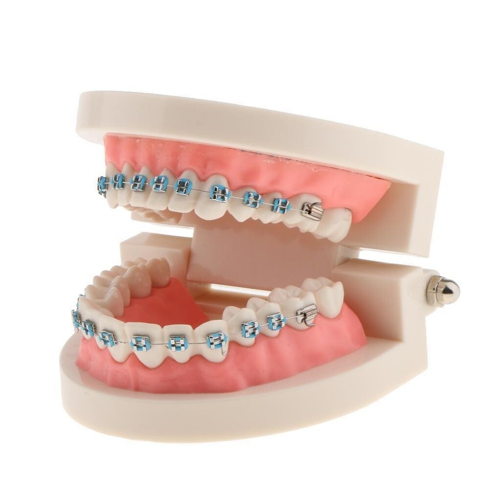 Dental Teach Typodont Demonstration Teeth Model with Braces For Patient Study
