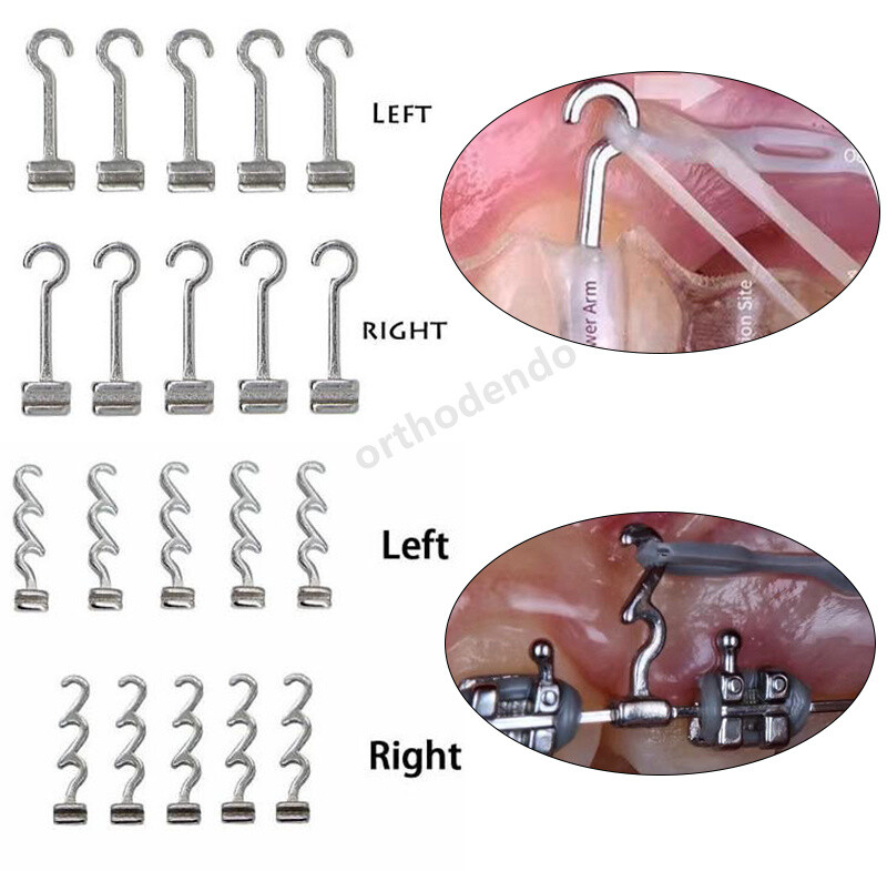 Dental Orthodontic Multi-function Hooks Sliding Crimpable Long Short Left/Right