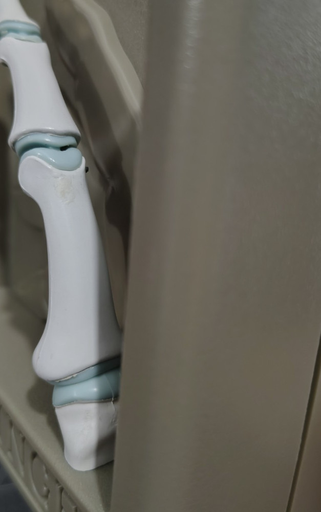 Syntex Naprosyn The Finger Demonstration Display Model - Model Only / No Insert