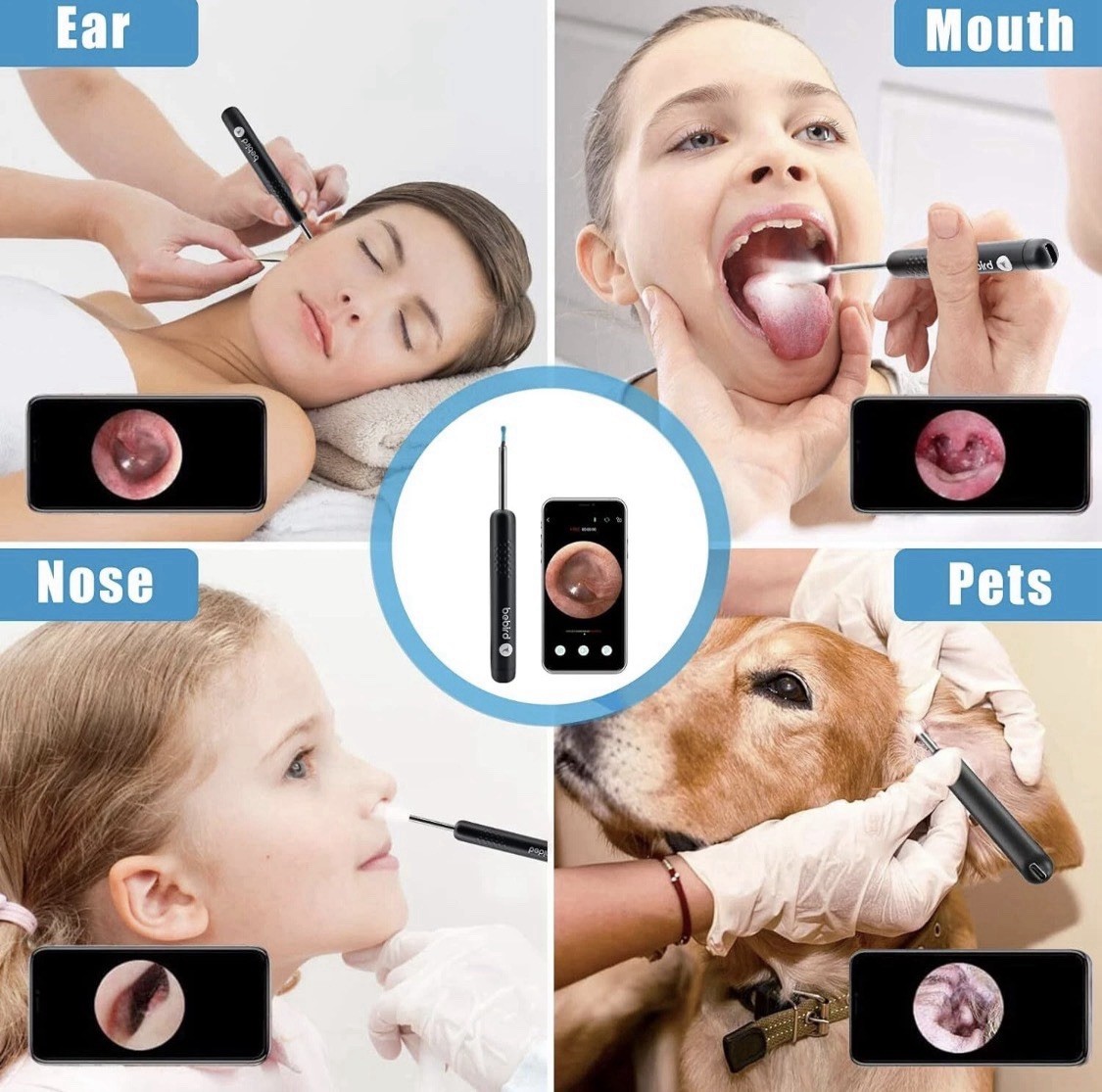 Wireless Ear Wax Remover Set, 1296P Camera HD Ear Endoscope Spoon Pick Tools.