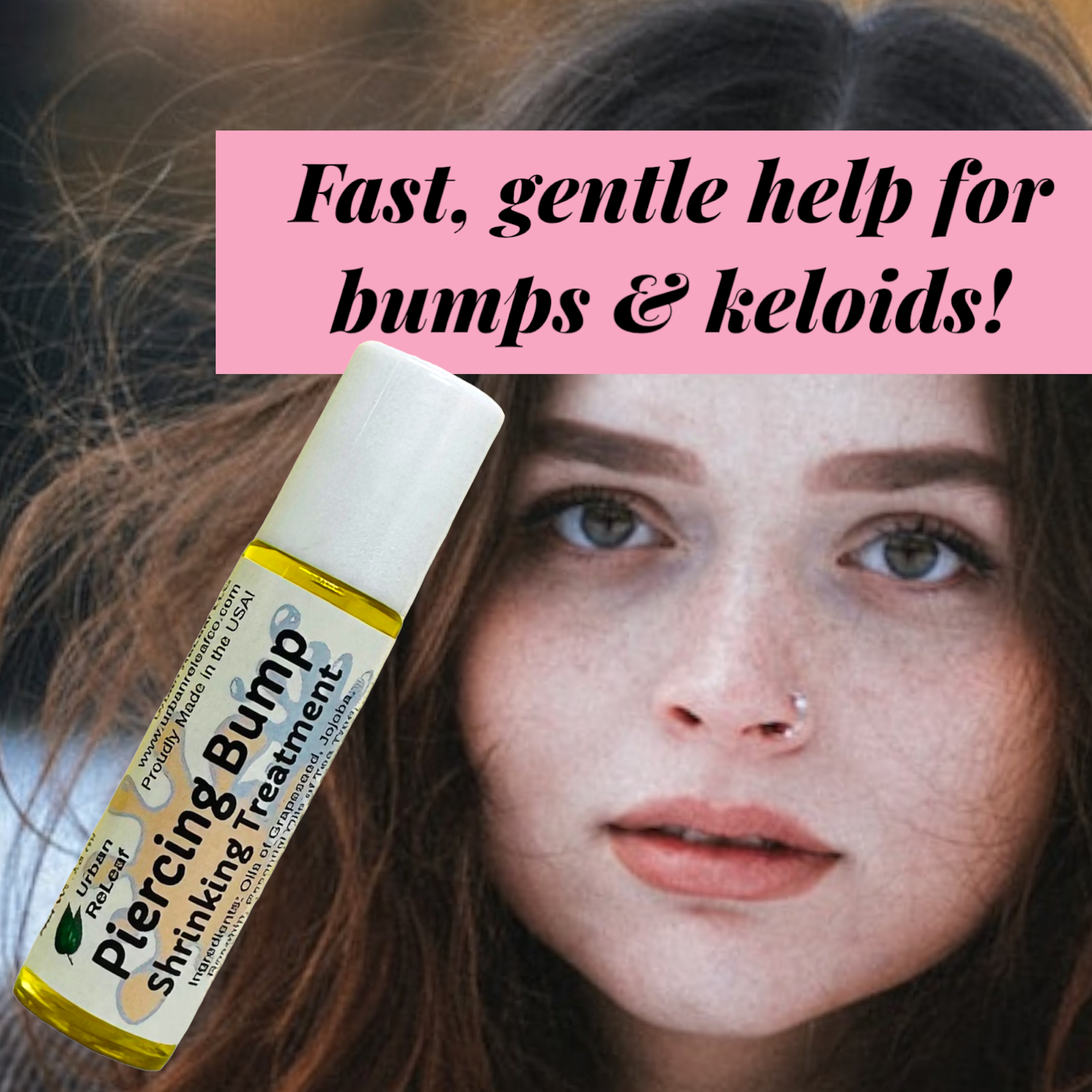 Urban ReLeaf Piercing Bump Shrinking Treatment! Aftercare Keloid Scar Cartilage