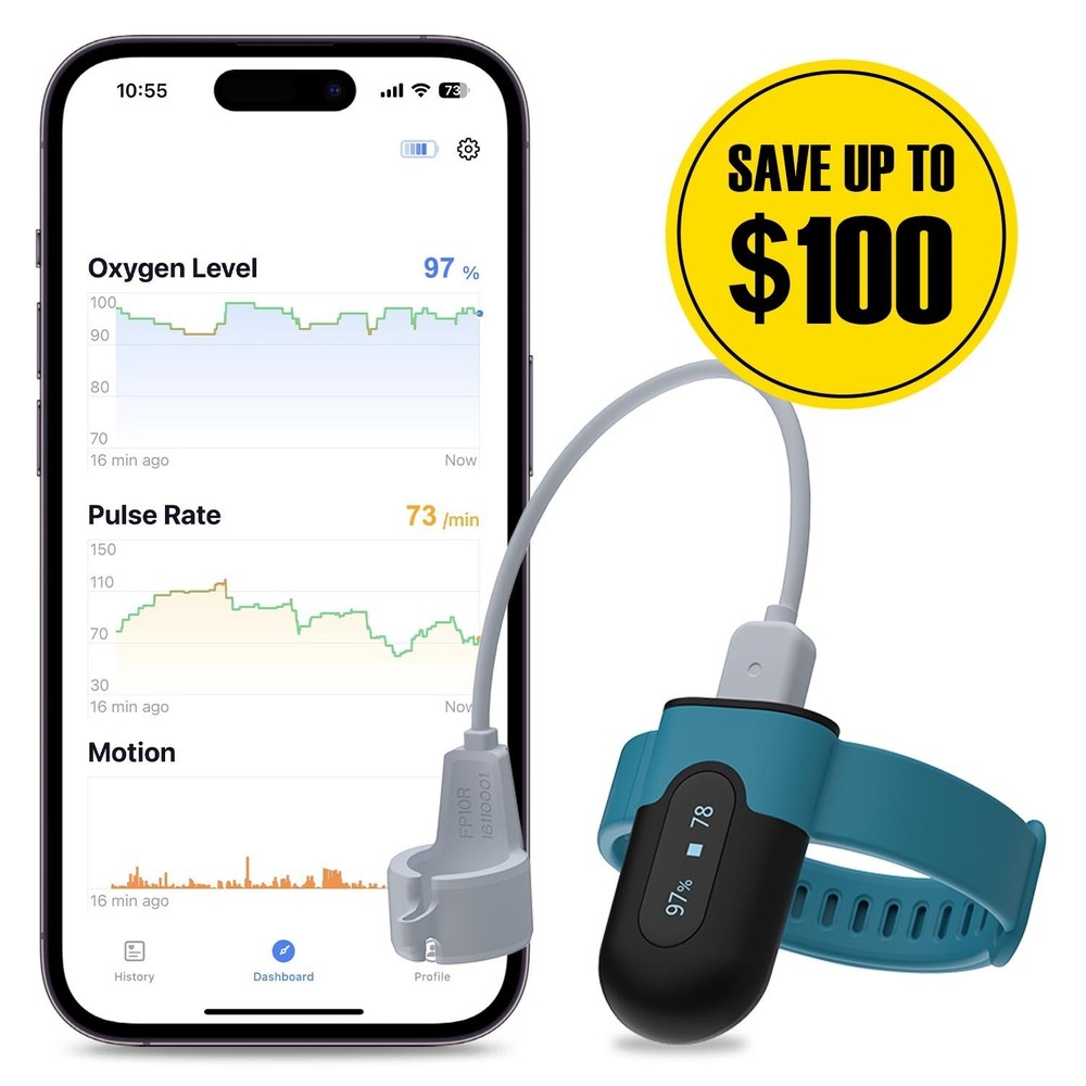 Vibeat OxyU Pulse Oximeter With App/PC Software Continuous O2 & HR
