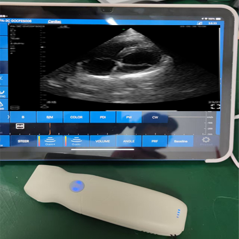 Color Wireless Ultrasound Doppler Phased Array Cardiac Probe Include CW Mode