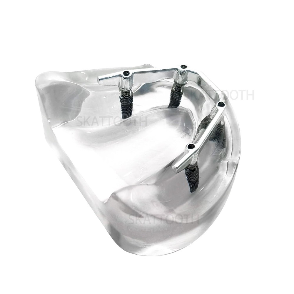 Dental Implant Teeth Model with Silver Bar Typodont Overdenture Teaching Model