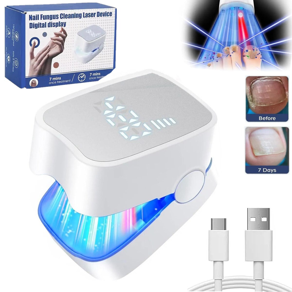 Nail Fungus Laser Treatment Device for Multiple Toenail Onychomycosis Remover US