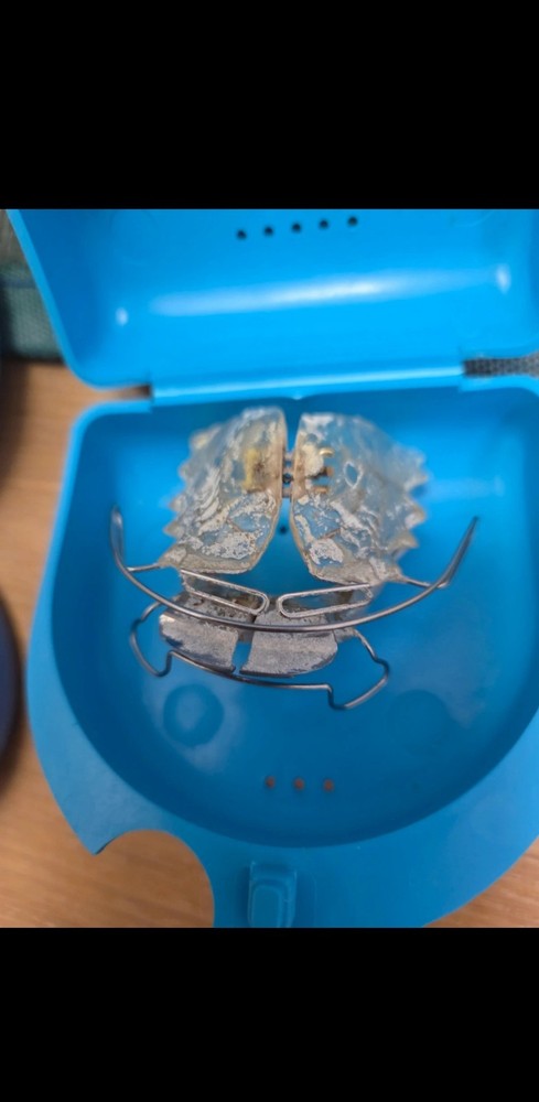 Orthodontic Appliance