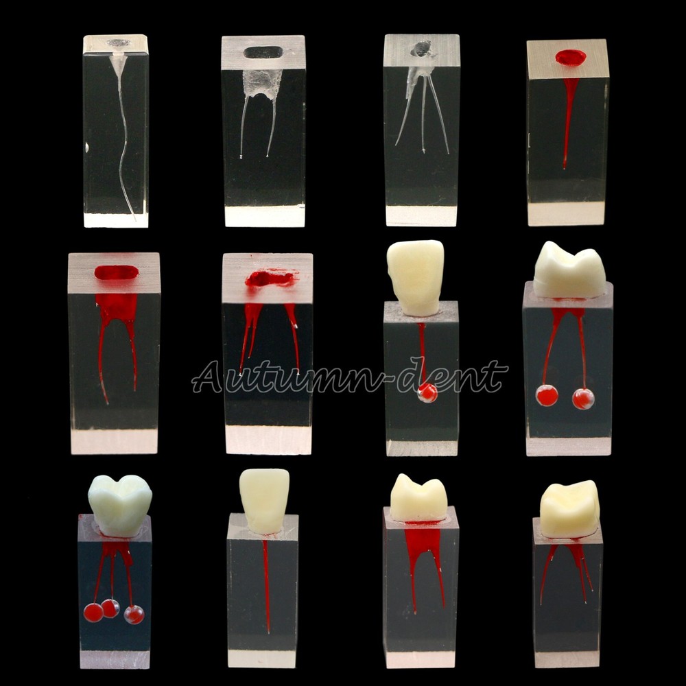 10Pcs Dental Endo Root Canal Teeth Model Practice Block RCT Pulp Cavity Study