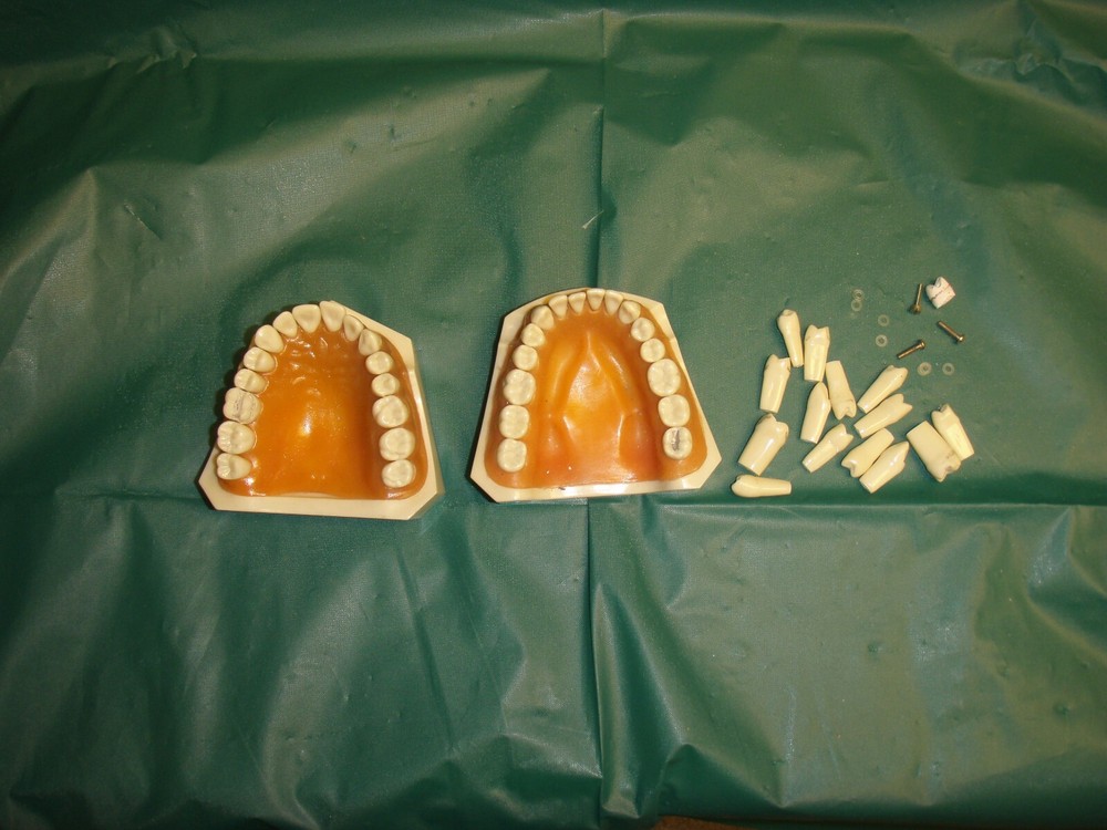 Dental Typodont with extra teeth