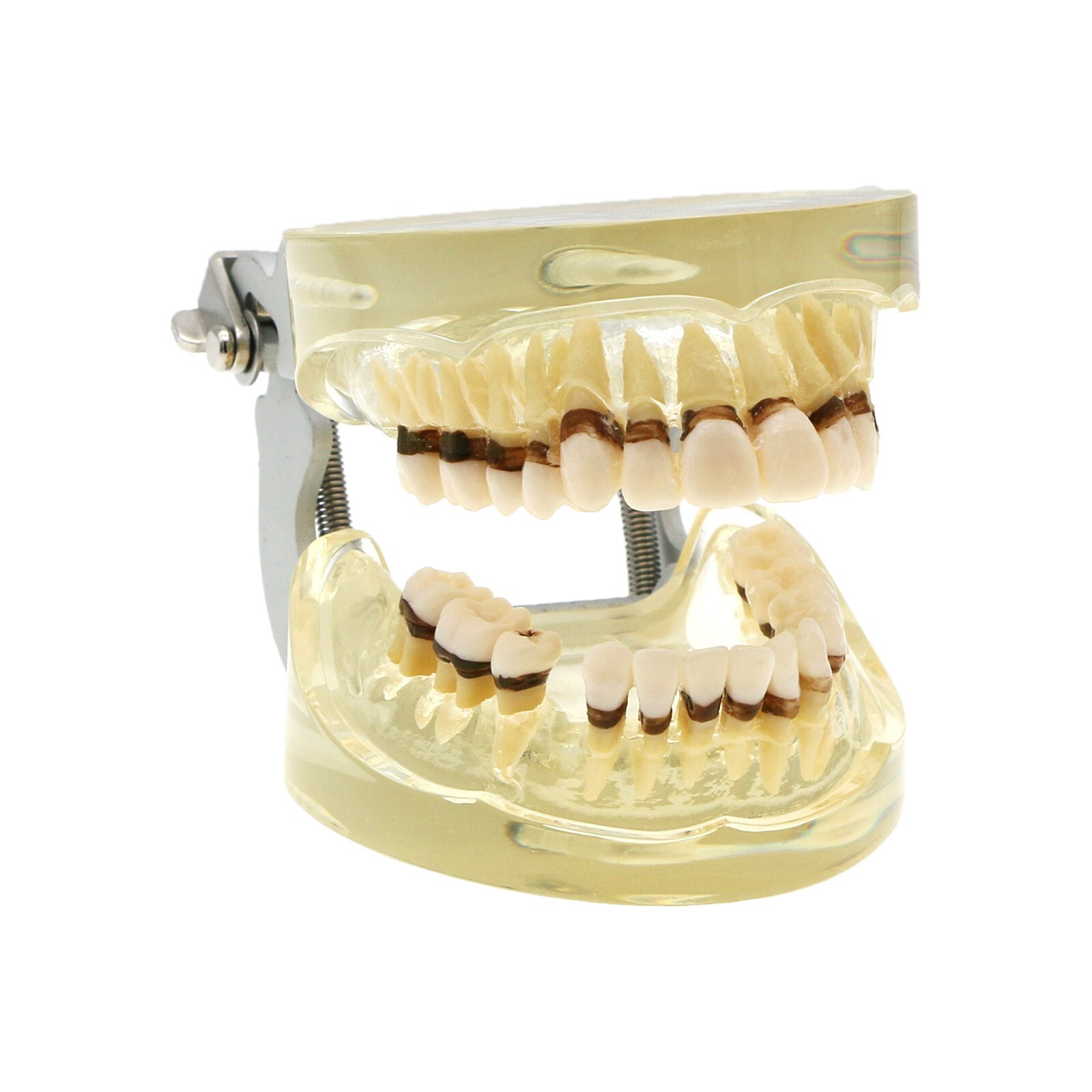 Dental Adult Periodontal Disease Pathological Teeth Typodont Model Removable Gum