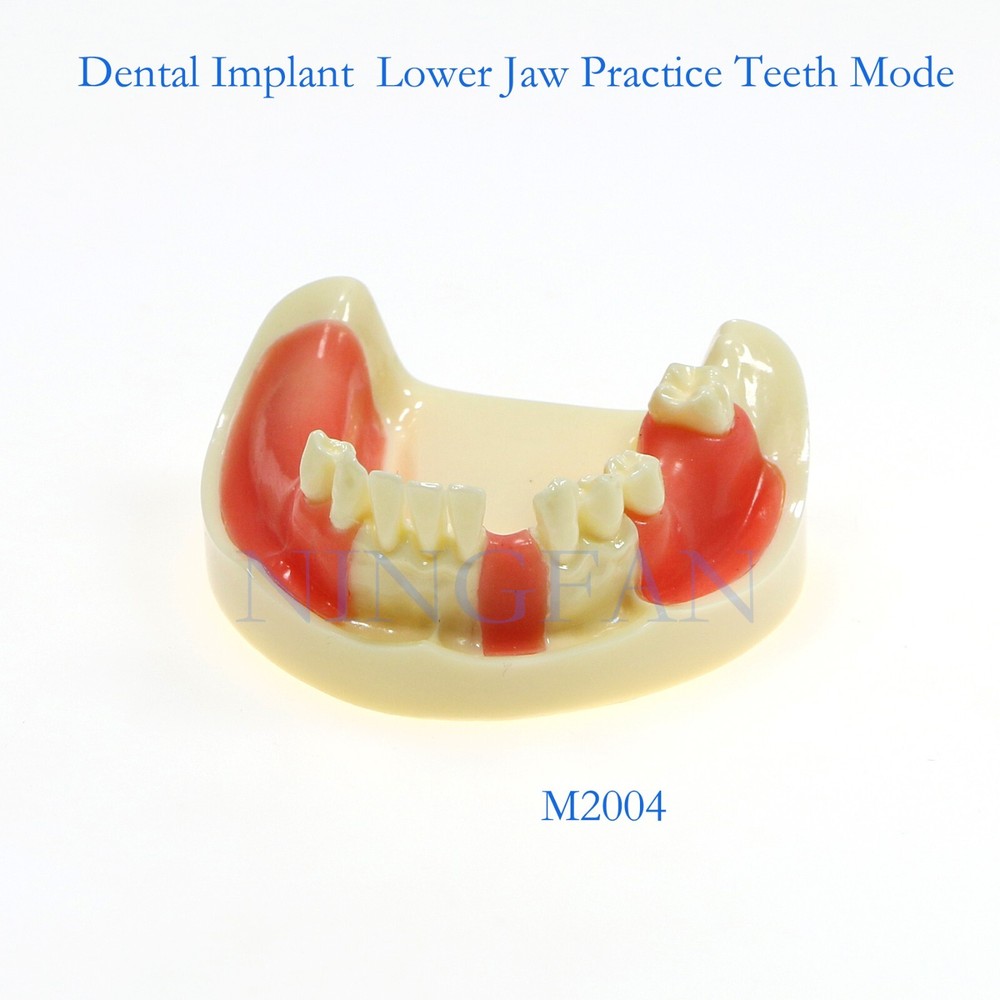 Dental Implant Practice Model, Lower Jaw Drilling, Maxillary Sinus Lifting Type
