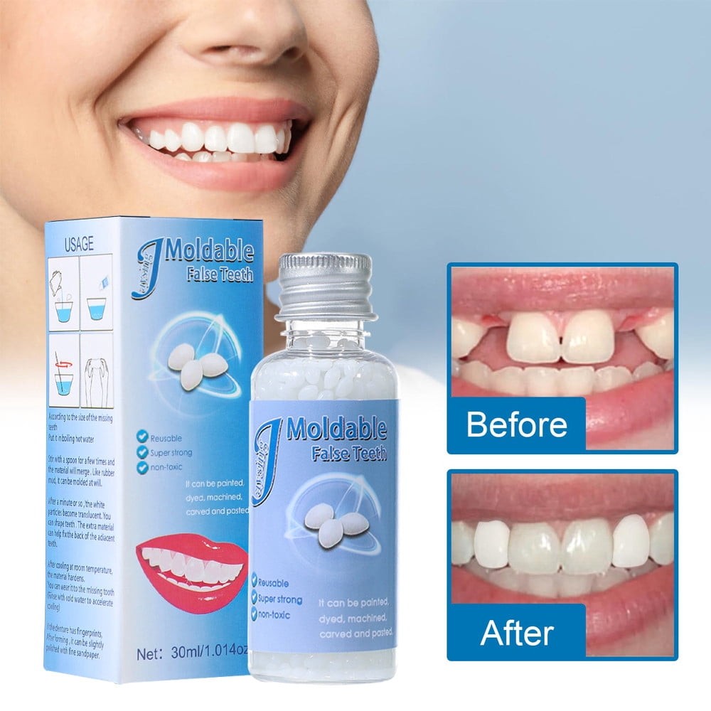 Tooth Repair Granules Temporary Fitting Beads Reusable Moldable False Teeth