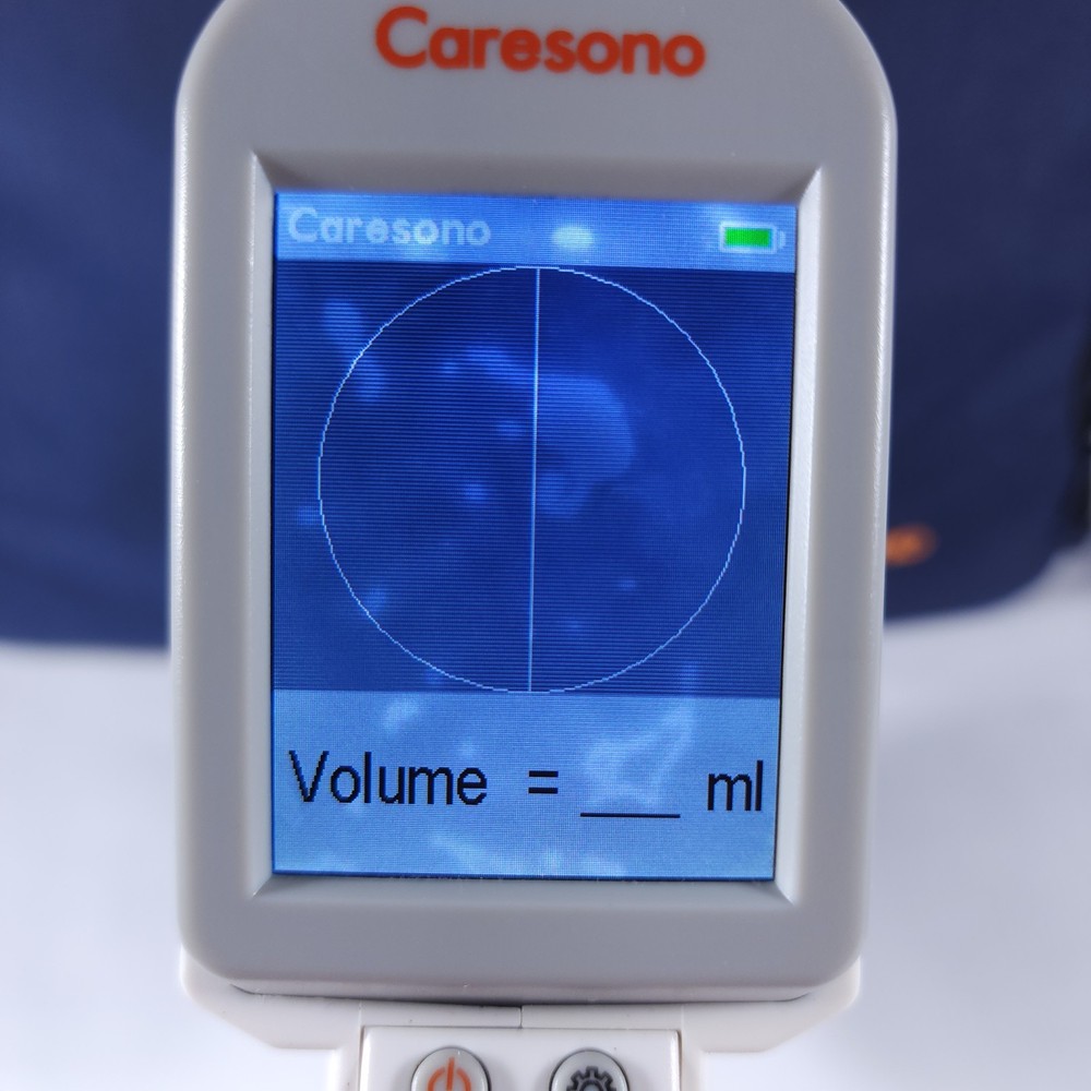💥 Caresono Padscan HD 2 Bladder Scanner Unable To Fully Test *Read Description*