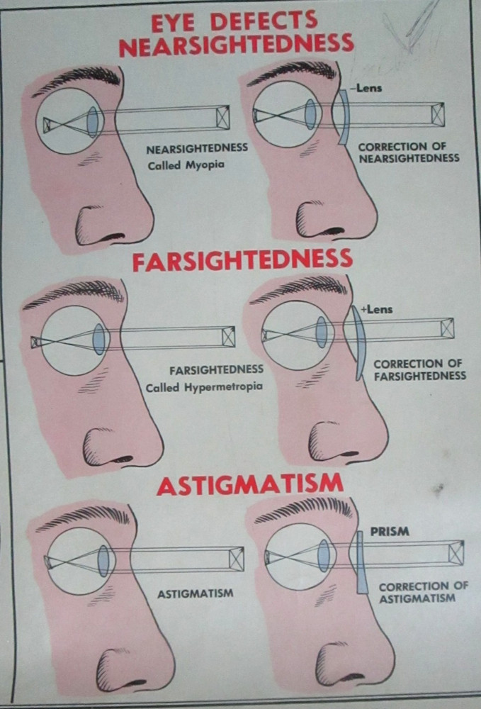 1955 Optical Instruments School Teaching Chart. W.M. Welch Co