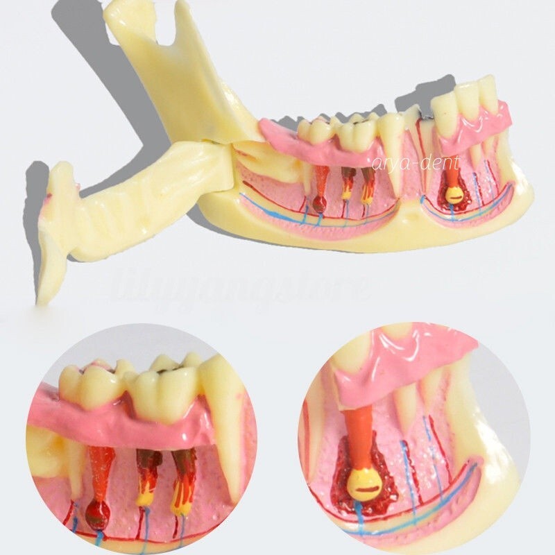 Dental Mandibular Tissue Teeth Anatomical Model Study Treatment Teach Model