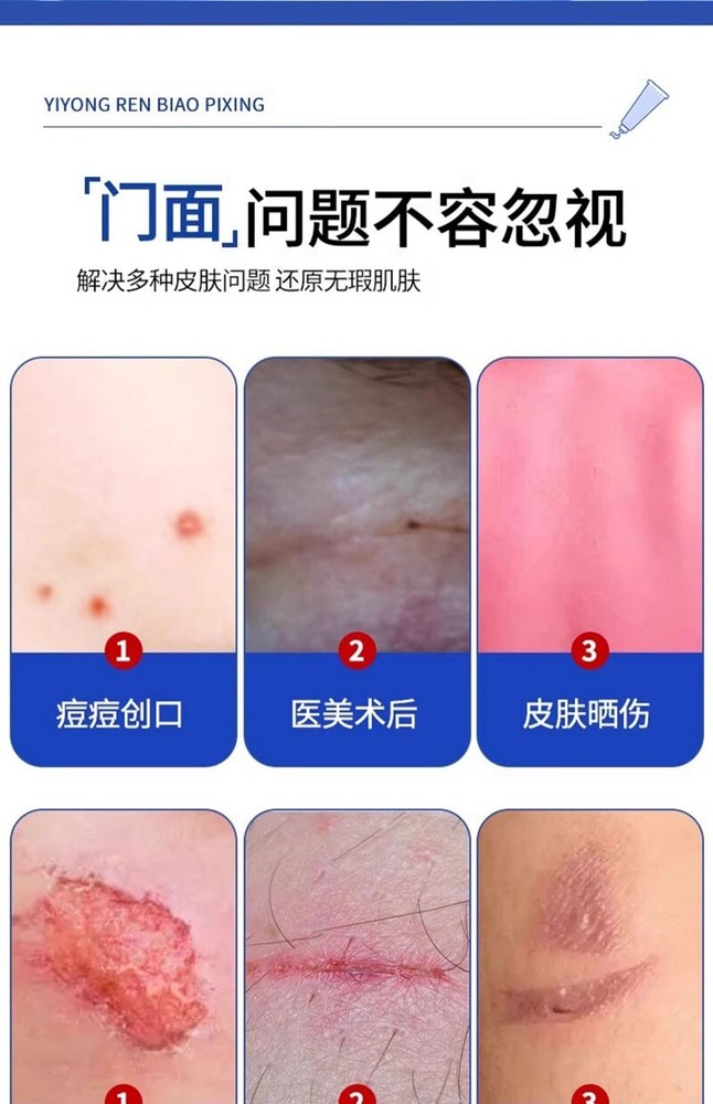 Growth Repair Gel 易孚郎朗 外用疤痕辅料 10g/支 人表皮生产因子凝胶