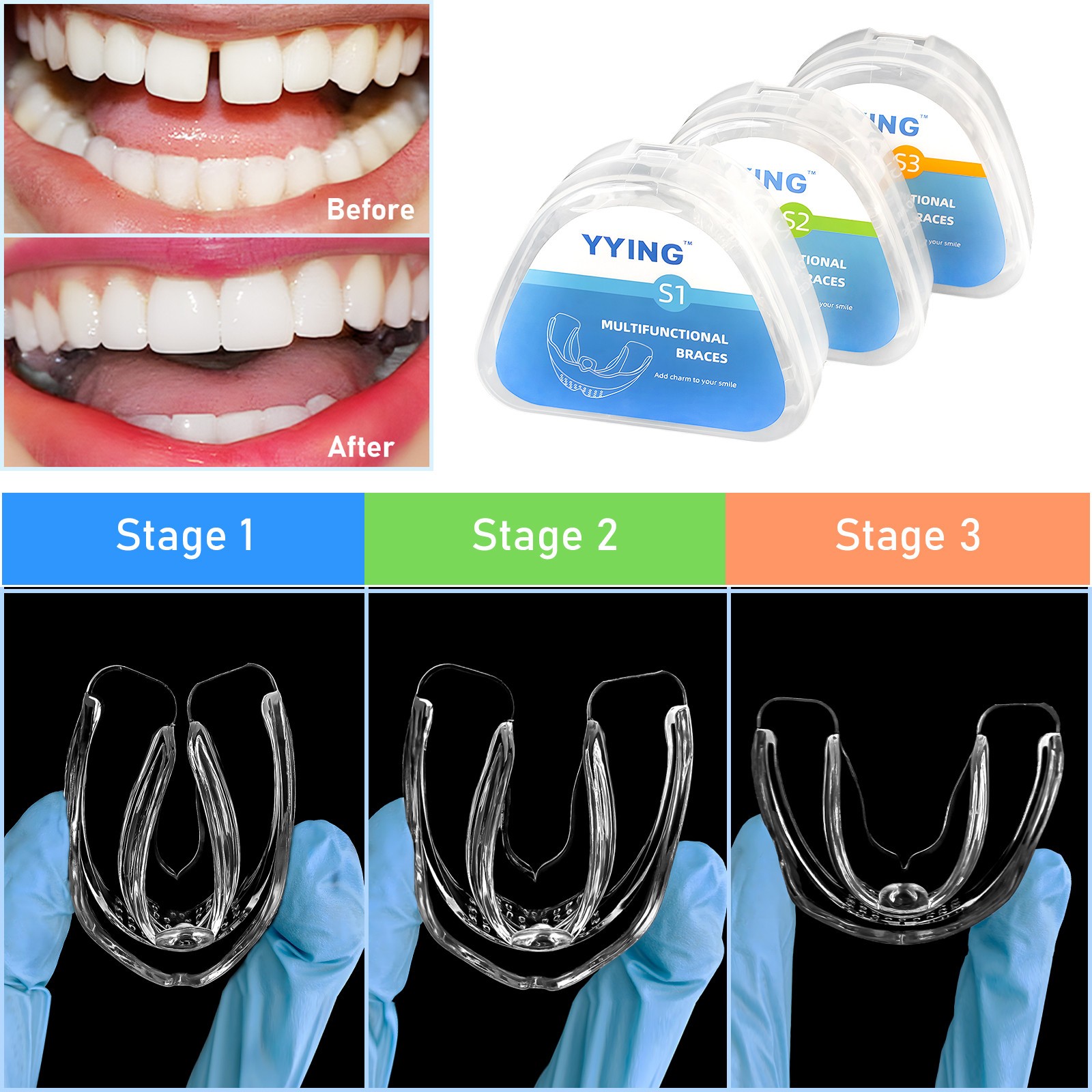 3 Stage Dental Orthodontic Teeth Corrector Braces Tooth Straightening Retainer