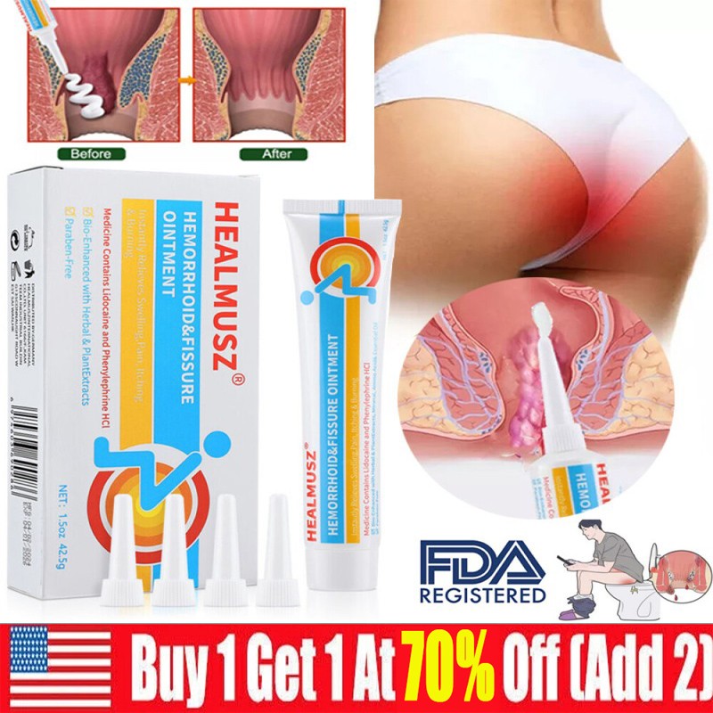 Hemorrhoids Remove Ointment Herbal Cream Relief Piles Pain Reduce Itching 42.5g