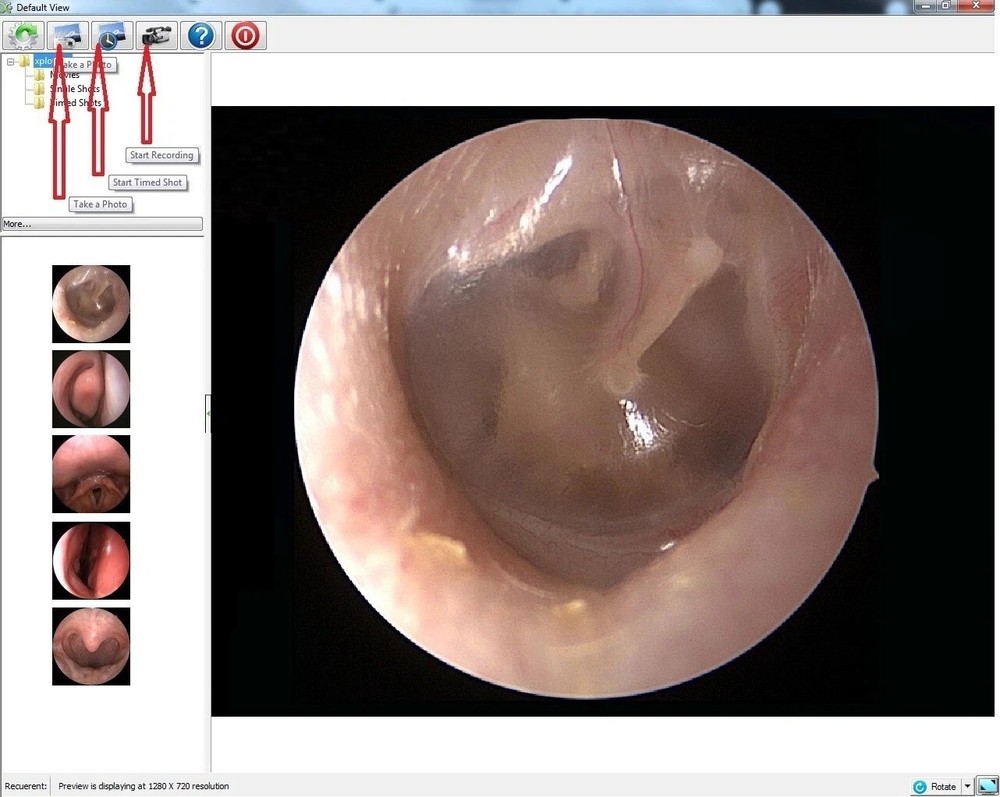 Rigid Endoscope Endoscopy for Dyonics HD USB Camera+Coupler+Light Source+Mount