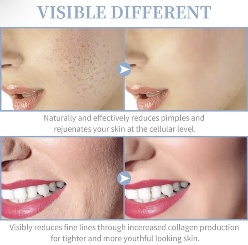 portable high frequency facial machine