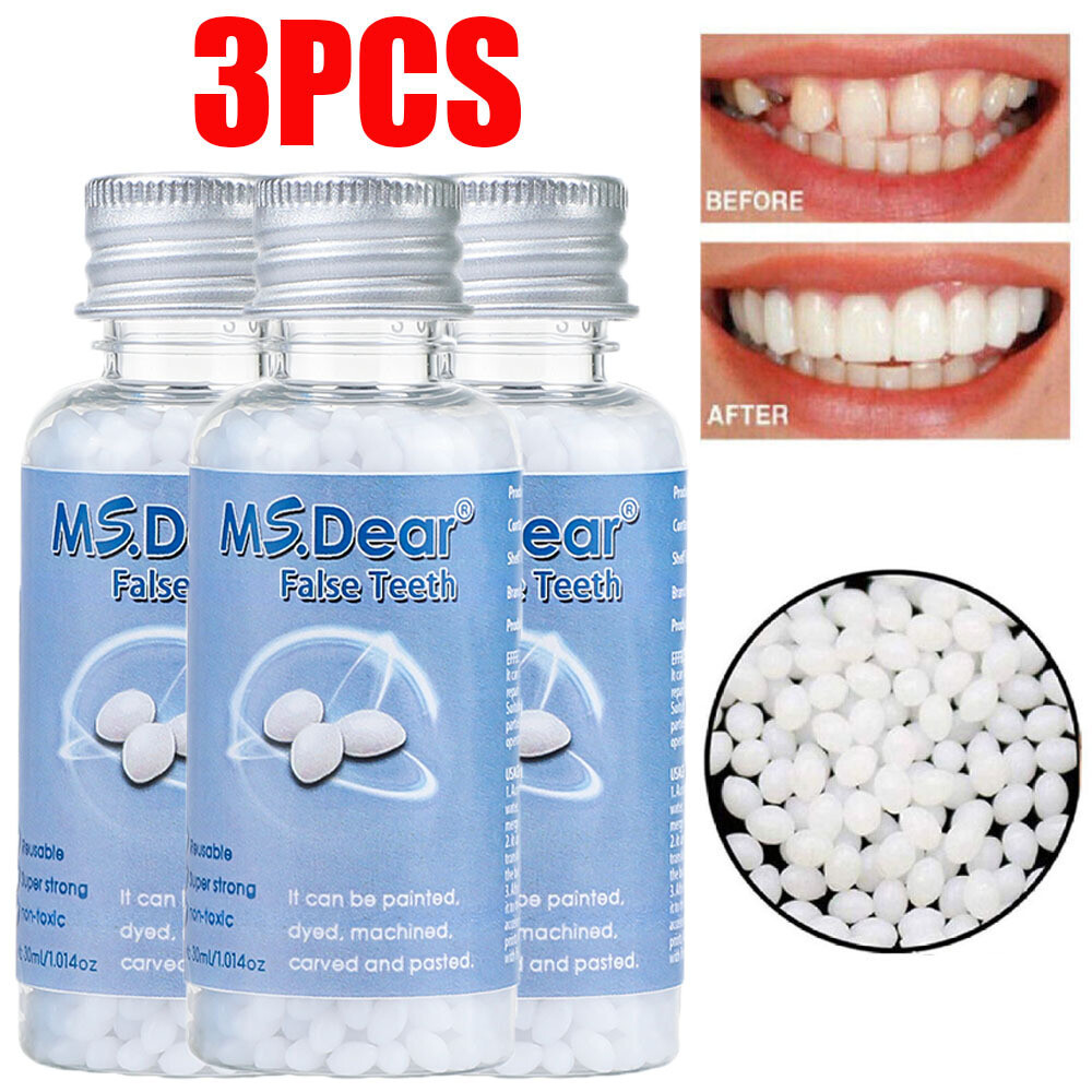 3X Tooth Repair Kit - Temporary Teeth Replacement Kit for Missing & Broken Teeth