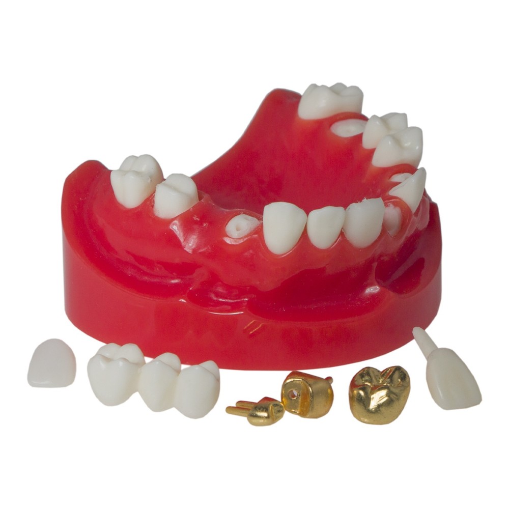 Dental M6004 Teaching Typodont Restoration Teeth Model Crown Post Core Bridge