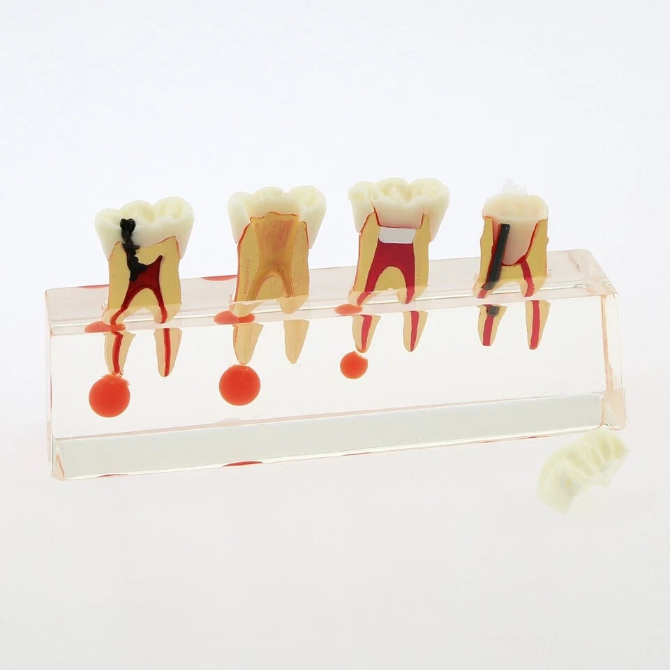 Dental Teeth Demonstrate Model #4018 Root Canal 4Stage Study Teaching Instrument