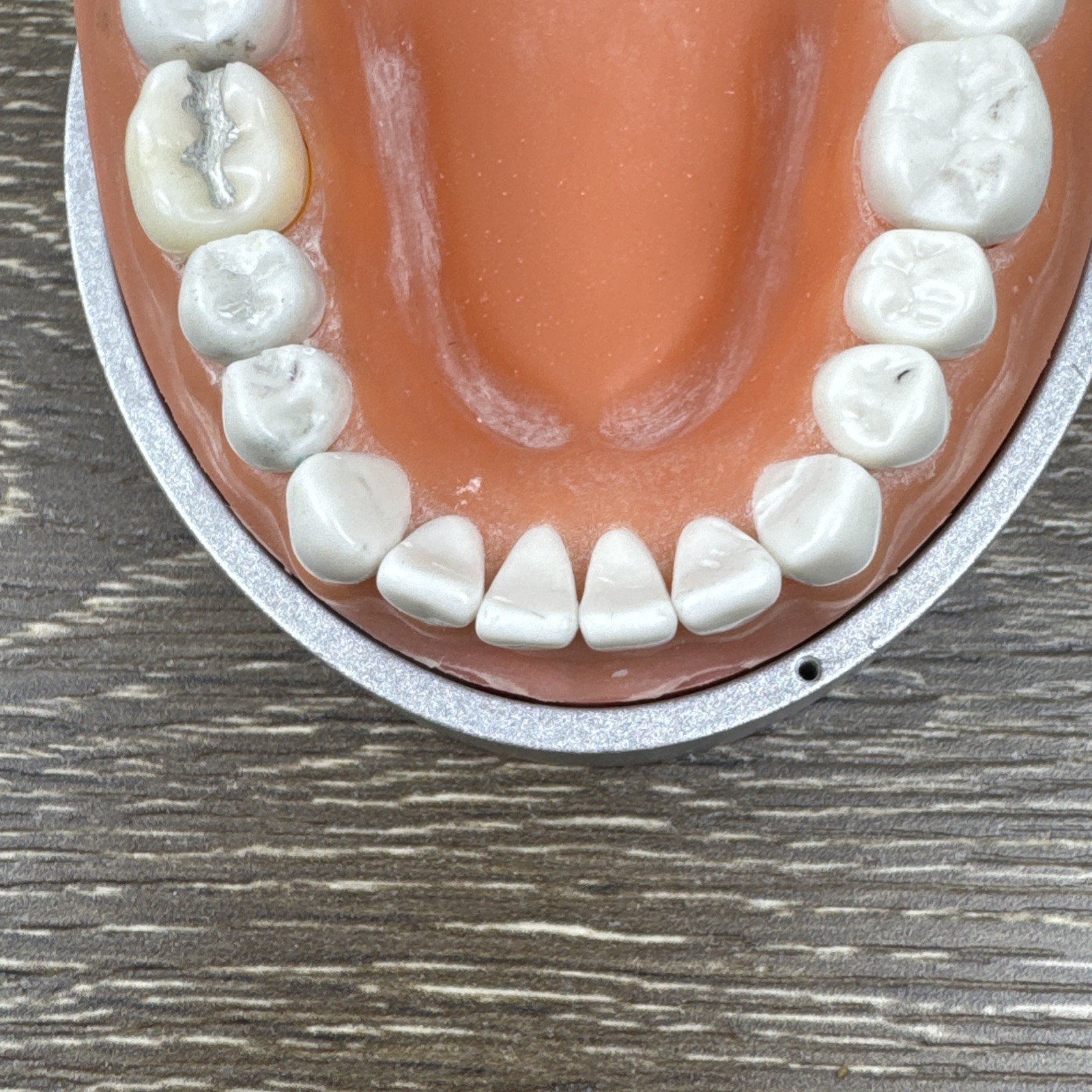 Acadental ModuPRO MP_R320 Restoration Typodont & Case WREB CDCA ADEX Teeth #54