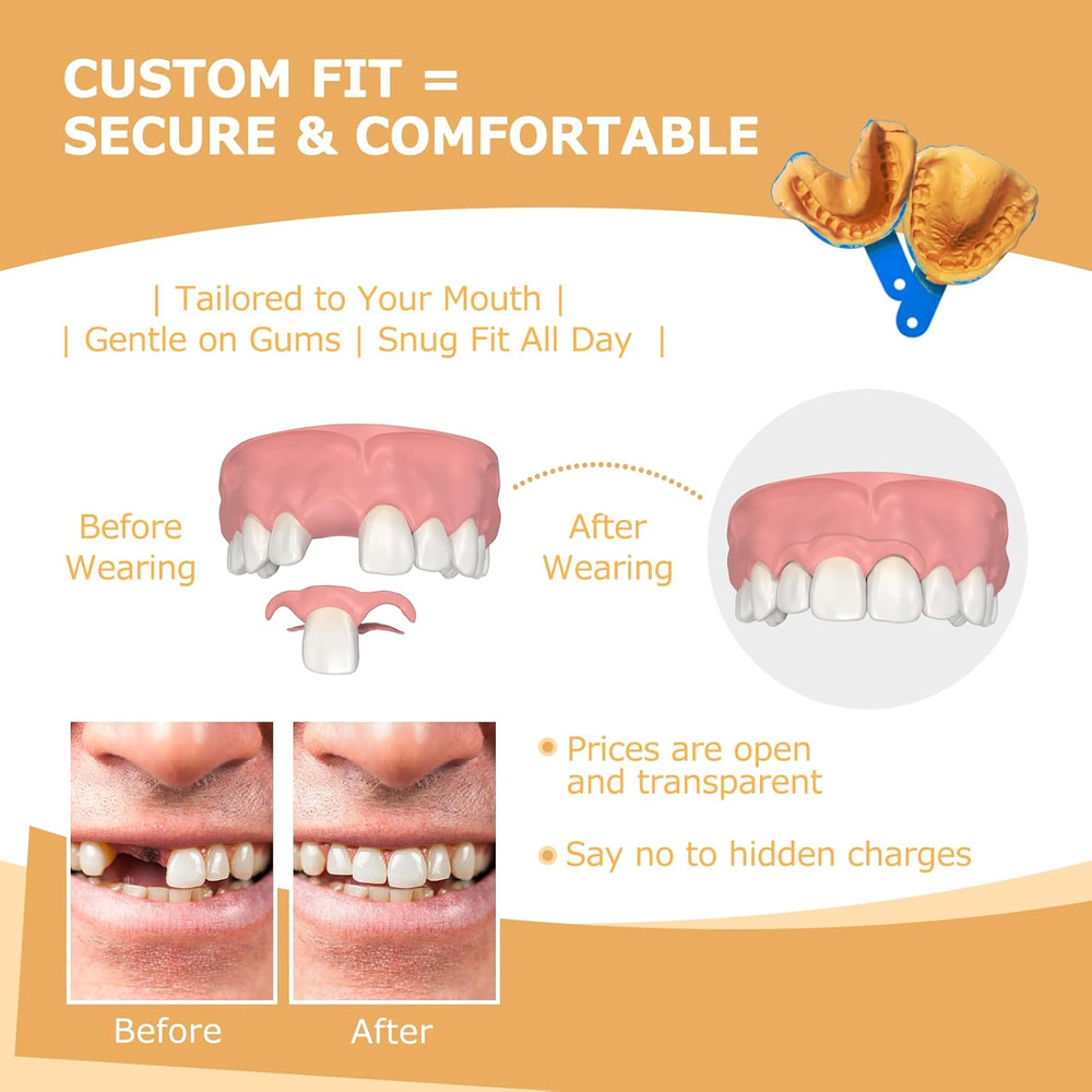 Partial Dentures - Dentures for Missing Teeth & Gaps - Lightweight & Unbreakable
