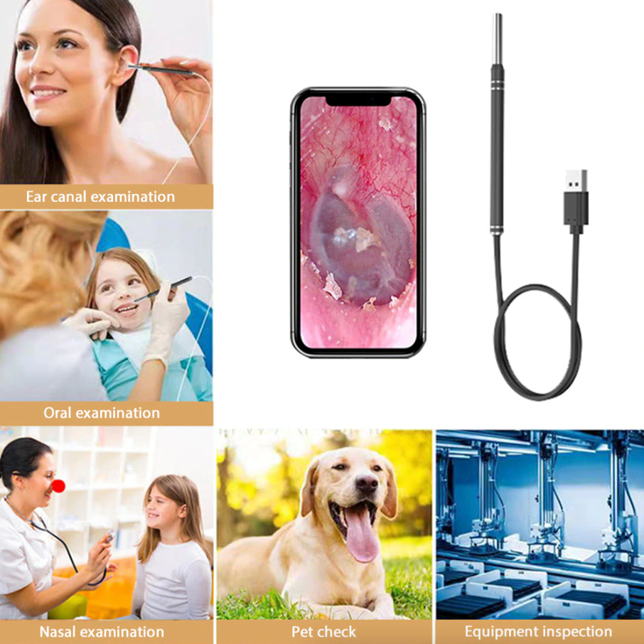 LED Ear Endoscope HD Otoscope Ear Wax Cleaning Camera Tool Cleaner Removal Kit