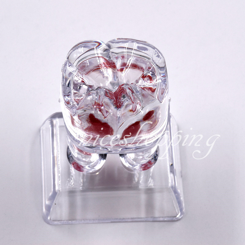 1x Dental Separable Crystal Base Hard Plastic Teeth model Tooth Molar Model