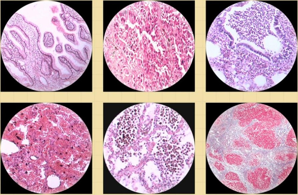 100PCS Mammal Pathological Section Typical Prepared Specimen Slides