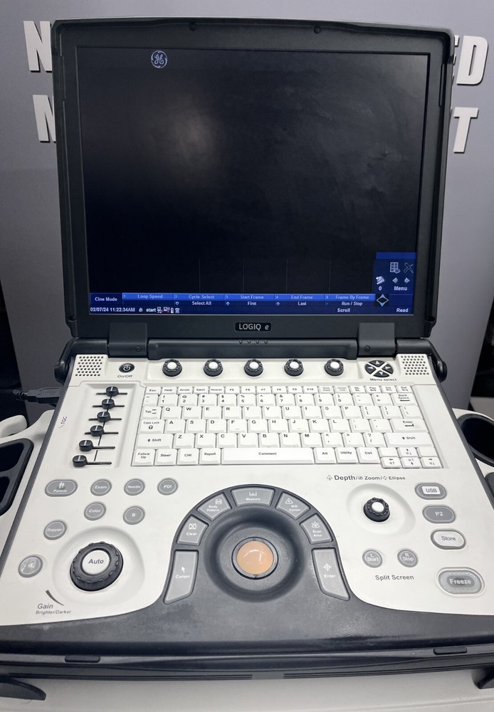 GE Logiq E - Good Working Condition