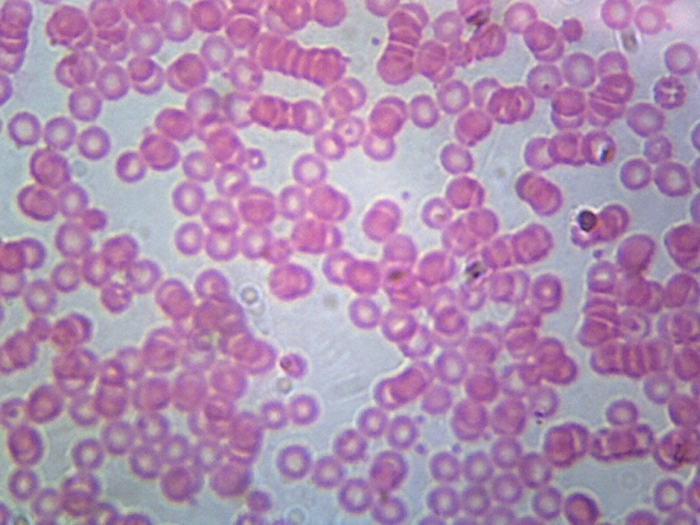Human Blood; Smear; H&E Stain