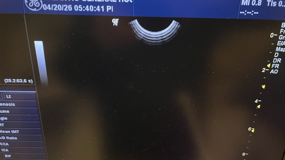 GE E8C-RS Ultrasound Probe Tested 2007