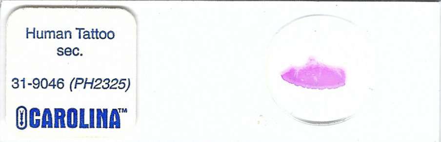 Human Tattoo Pathology Microscope Slide