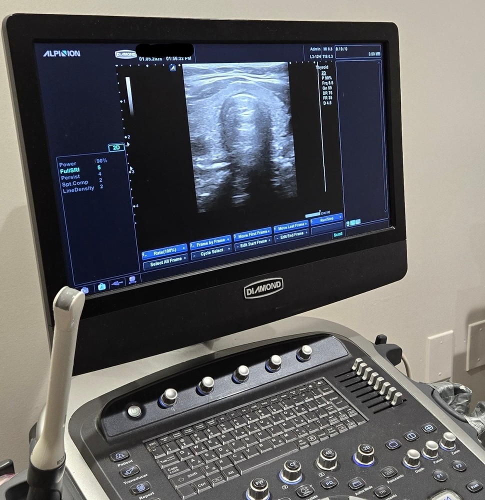 Alpinion ECube 9 Diamond w/ transducers