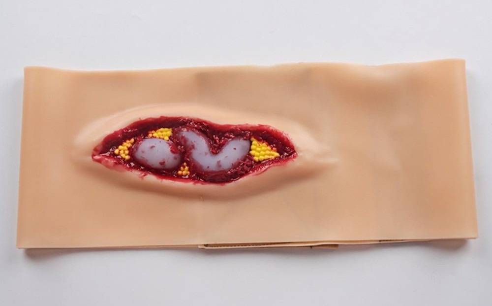 Abdominal Anatomical Wound Training Model