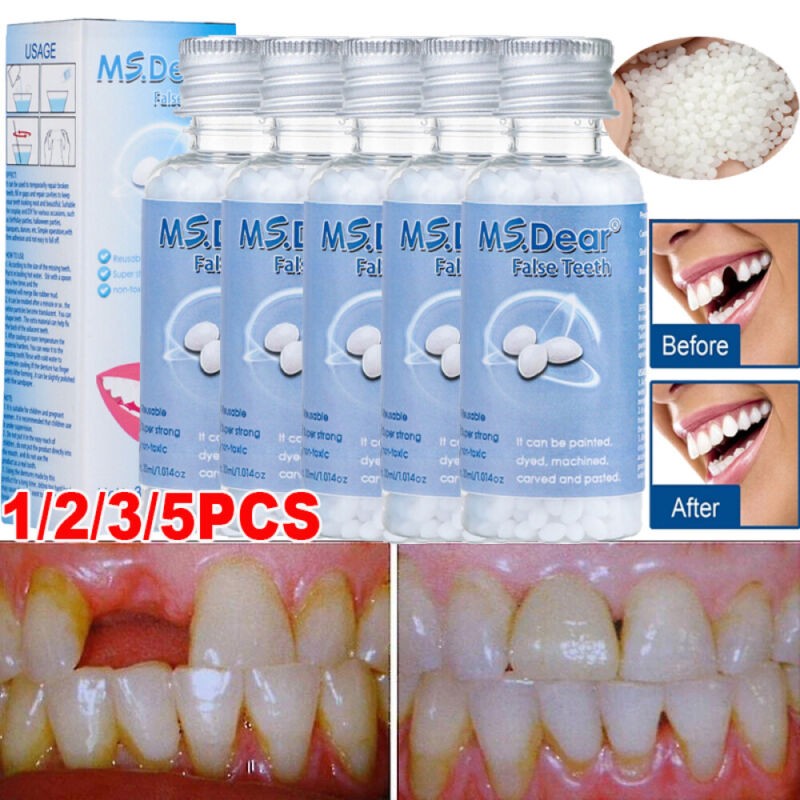 Teeth Repair Temporary Fix Kit Fitting Beads Reusable Fast Moldable False Tooth