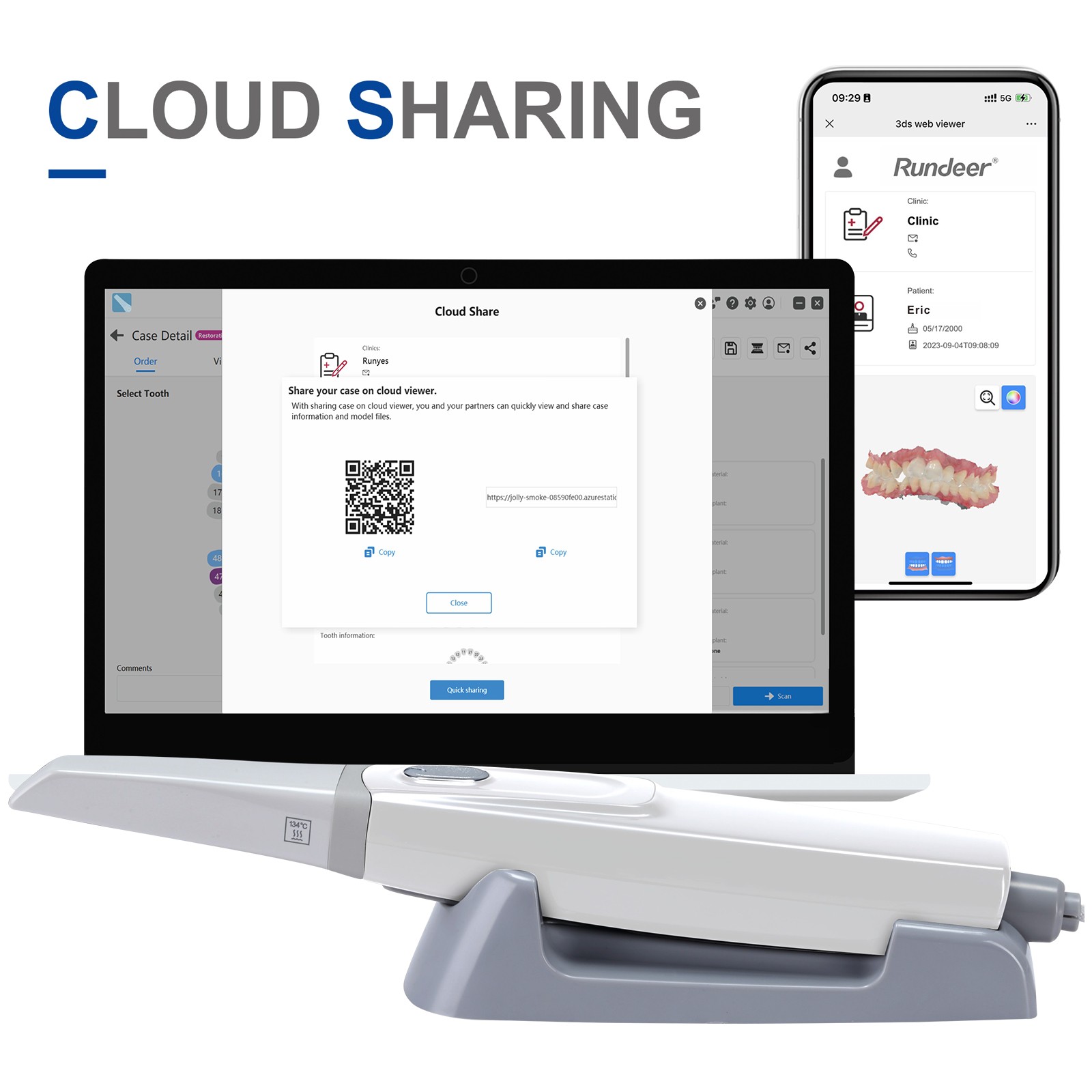 Dental Digital Imaging Scanner for Restorations, Implants 3D Intraoral Scanner